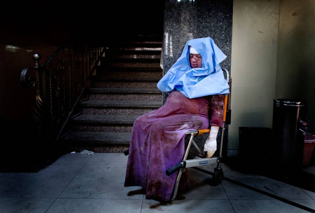 Den gravida kvinnan har skadats i en granatattack. Nu sitter hon avsvimmad på sjukhuset och väntar på vård. Foto: NICLAS HAMMARSTRÖM (oktober 2012)